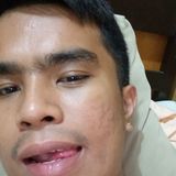 James from Angeles City | Man | 31 years old | Cancer